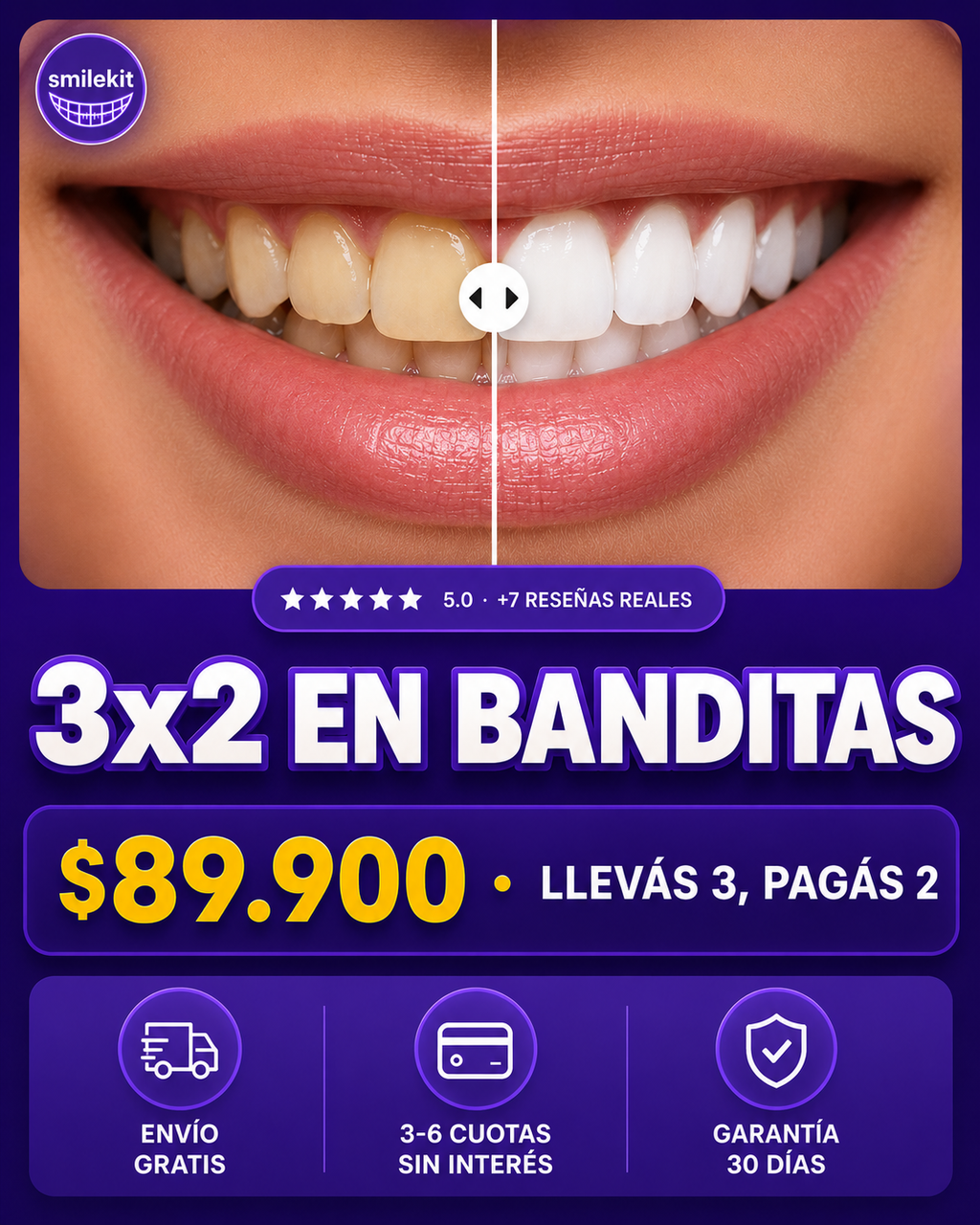Kit de Bandas Blanqueadoras PAP+ · Rutina 14 Días